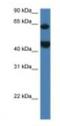 Lysophosphatidylcholine Acyltransferase 2 antibody, NBP1-79206, Novus Biologicals, Western Blot image 