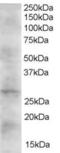 Dickkopf WNT Signaling Pathway Inhibitor 2 antibody, 45-484, ProSci, Enzyme Linked Immunosorbent Assay image 