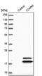 ECRG4 Augurin Precursor antibody, PA5-52576, Invitrogen Antibodies, Western Blot image 