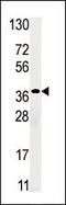 Ribokinase antibody, 62-711, ProSci, Western Blot image 