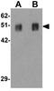 Tripartite Motif-Containing 51 antibody, GTX31446, GeneTex, Western Blot image 