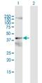 Phosphate Cytidylyltransferase 2, Ethanolamine antibody, H00005833-D01P, Novus Biologicals, Western Blot image 