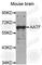 Apoptosis Antagonizing Transcription Factor antibody, A5896, ABclonal Technology, Western Blot image 