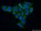 Hexosaminidase Subunit Alpha antibody, 11317-1-AP, Proteintech Group, Immunofluorescence image 