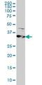 Ribonucleotide Reductase Regulatory Subunit M2 antibody, ab57653, Abcam, Western Blot image 