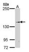 Transient Receptor Potential Cation Channel Subfamily M Member 2 antibody, orb73814, Biorbyt, Western Blot image 