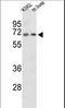 Carnitine O-Octanoyltransferase antibody, LS-C167055, Lifespan Biosciences, Western Blot image 