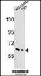 EPH Receptor A3 antibody, 63-040, ProSci, Western Blot image 