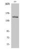 Tyrosine Kinase 2 antibody, STJ96156, St John