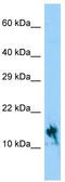 IGF Like Family Member 1 antibody, TA333353, Origene, Western Blot image 