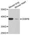 CCAAT Enhancer Binding Protein Beta antibody, A0711, ABclonal Technology, Western Blot image 
