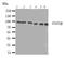 Signal Transducer And Activator Of Transcription 5B antibody, LS-C312984, Lifespan Biosciences, Western Blot image 