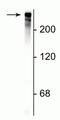 MAP2 antibody, GTX82661, GeneTex, Western Blot image 