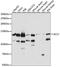 ATP Citrate Lyase antibody, A15251, ABclonal Technology, Western Blot image 