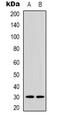 Acyl-CoA Binding Domain Containing 6 antibody, LS-C368880, Lifespan Biosciences, Western Blot image 