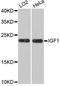 Insulin Like Growth Factor 1 antibody, A11985, ABclonal Technology, Western Blot image 