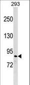 Zinc Finger Protein 7 antibody, LS-C157494, Lifespan Biosciences, Western Blot image 