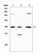 TIMP Metallopeptidase Inhibitor 4 antibody, A07131, Boster Biological Technology, Western Blot image 