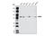 Ribonucleotide Reductase Catalytic Subunit M1 antibody, 3388S, Cell Signaling Technology, Western Blot image 