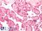 G Protein-Coupled Estrogen Receptor 1 antibody, LS-A4272, Lifespan Biosciences, Immunohistochemistry paraffin image 