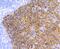 Keratin 5 antibody, A00398-1, Boster Biological Technology, Immunohistochemistry paraffin image 