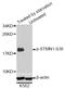 Stathmin 1 antibody, STJ22422, St John