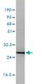 CD58 Molecule antibody, H00000965-M01, Novus Biologicals, Western Blot image 