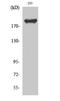 WNK1 antibody, STJ96271, St John