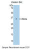 Gap Junction Protein Beta 3 antibody, LS-C300300, Lifespan Biosciences, Western Blot image 