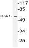 DAB Adaptor Protein 1 antibody, AP20741PU-N, Origene, Western Blot image 