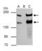 Slit homolog 2 protein antibody, GTX118220, GeneTex, Immunoprecipitation image 