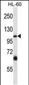 Short transient receptor potential channel 5 antibody, PA5-35135, Invitrogen Antibodies, Western Blot image 