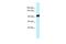 Zinc Fingers And Homeoboxes 1 antibody, A06590, Boster Biological Technology, Western Blot image 