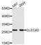 C-Type Lectin Domain Family 4 Member D antibody, STJ23168, St John