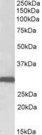 Stomatin antibody, NBP2-26195, Novus Biologicals, Western Blot image 