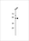 Fucosyltransferase 8 antibody, MBS9211105, MyBioSource, Western Blot image 