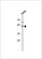 Fucosyltransferase 8 antibody, MBS9211105, MyBioSource, Western Blot image 