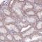 Ribonuclease A Family Member 10 (Inactive) antibody, HPA052593, Atlas Antibodies, Immunohistochemistry paraffin image 