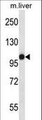 Microtubule Associated Serine/Threonine Kinase Like antibody, LS-C164481, Lifespan Biosciences, Western Blot image 