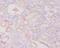 Colony Stimulating Factor 3 antibody, LS-C285666, Lifespan Biosciences, Immunohistochemistry paraffin image 