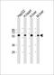 Cryptochrome Circadian Regulator 2 antibody, M00792, Boster Biological Technology, Western Blot image 