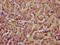 Testin LIM Domain Protein antibody, CSB-PA890679LA01HU, Cusabio, Immunohistochemistry paraffin image 