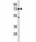 P21 (RAC1) Activated Kinase 4 antibody, F43855-0.4ML, NSJ Bioreagents, Western Blot image 