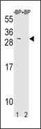 TIMP Metallopeptidase Inhibitor 3 antibody, PA5-26133, Invitrogen Antibodies, Western Blot image 