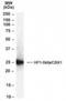 M31 antibody, NB100-2423, Novus Biologicals, Western Blot image 