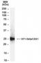 Chromobox protein homolog 1 antibody, NB100-2423, Novus Biologicals, Western Blot image 