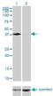 Poly(RC) Binding Protein 2 antibody, H00005094-M07, Novus Biologicals, Western Blot image 