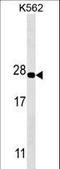 Proteasome Subunit Alpha 5 antibody, LS-B10531, Lifespan Biosciences, Western Blot image 