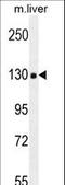 Collagen Type XVIII Alpha 1 Chain antibody, LS-C166919, Lifespan Biosciences, Western Blot image 