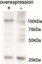 Alanyl-TRNA Synthetase 2, Mitochondrial antibody, PA5-37957, Invitrogen Antibodies, Western Blot image 